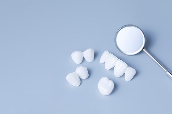 When Is A Dental Crown Necessary?